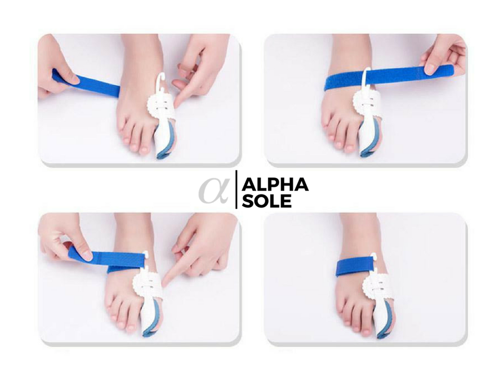 Alpha Night Bunion Corrector